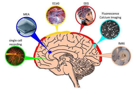 Technology - BrainAccess