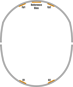 Projection bands electrode annotations