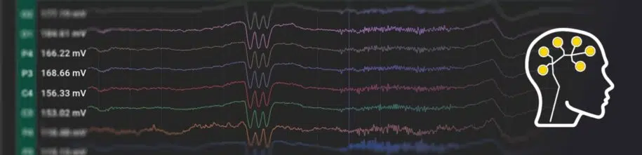 BrainAccess Board Version Update to 2.4.0 - BrainAccess