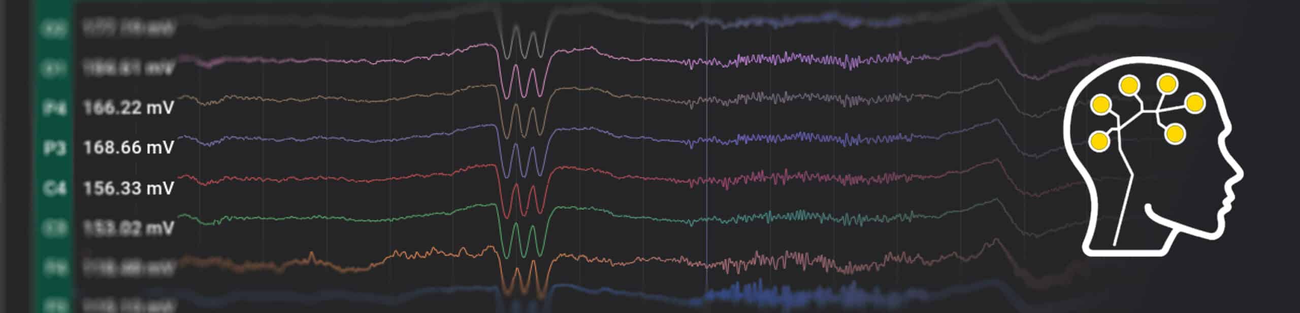 BrainAccess Board Windows Version Upgrade to 1.1.0 - BrainAccess