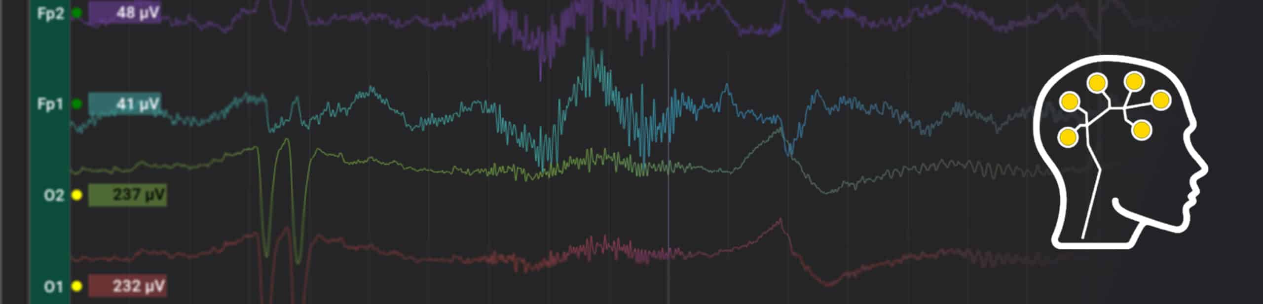 BrainAccess viewer