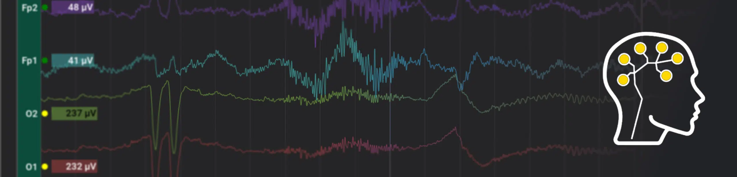 BrainAccess Board Version Update to 2.5.0 - BrainAccess