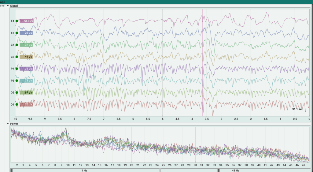 BrainAccess Release 2025: More Adaptable and Versatile Than Ever - BrainAccess