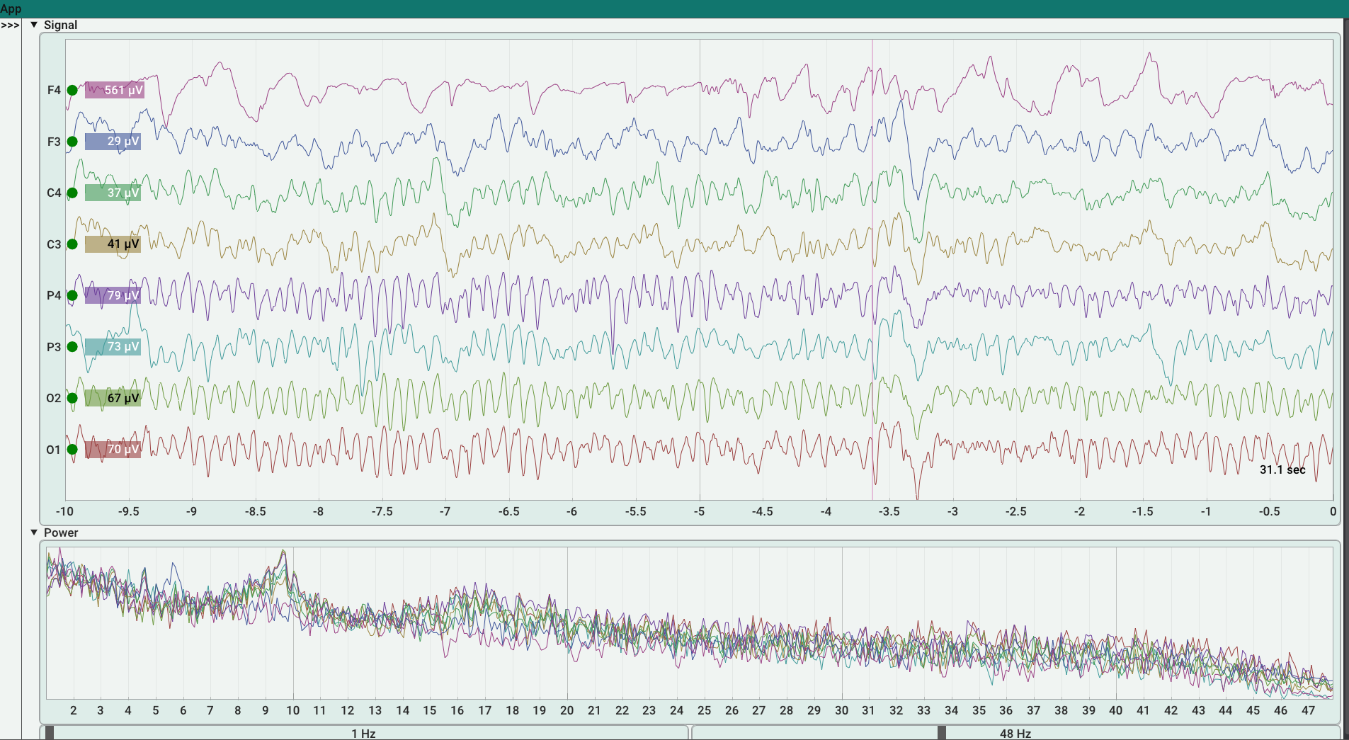 From Brain to Bytes: How EEG Data is Captured - BrainAccess