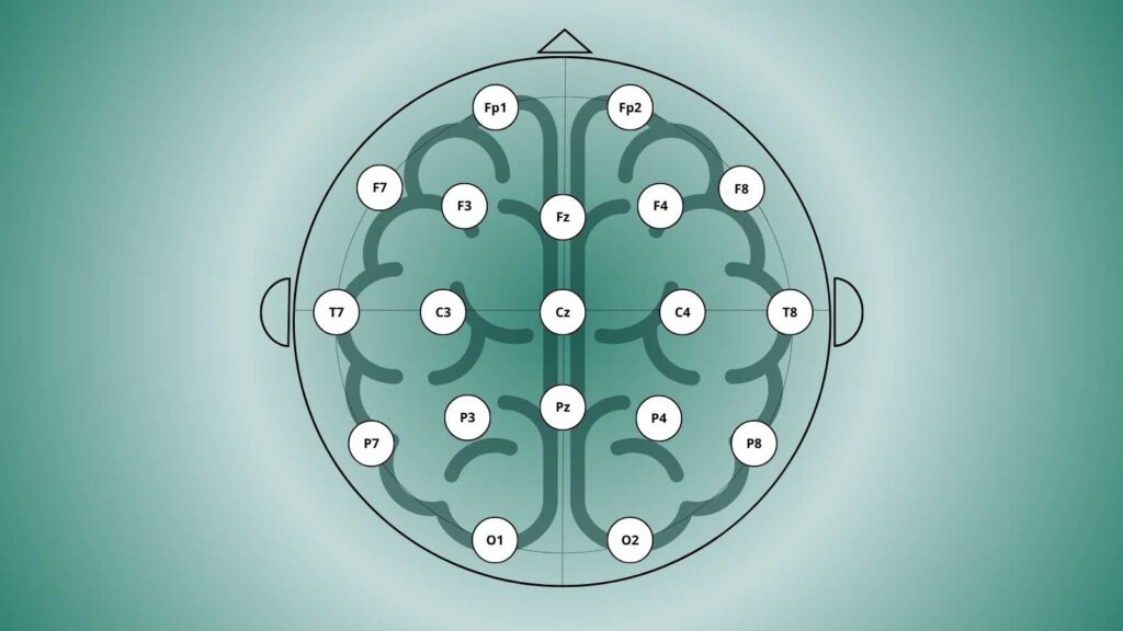 A Guide to EEG Electrode Placement: The 10–20 System Explained - BrainAccess A Guide to EEG Electrode Placement: The 10–20 System Explained